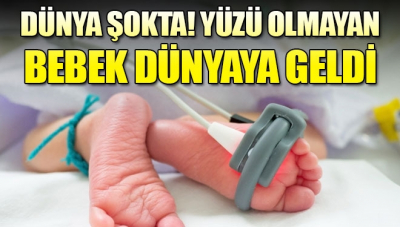 Bebek yüzü olmadan dünyaya geldi!